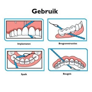 iDontix X-floss Lite - Blauw 3x 30 stuks