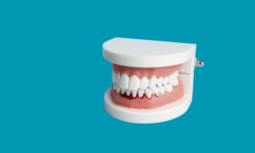 Wat te doen bij ontstoken tandvlees?