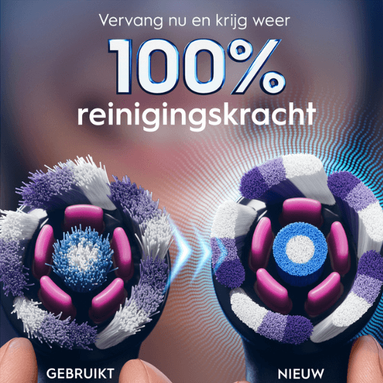 Oral-B iO Radiant White Opzetborstels | Zwart | 4 stuks