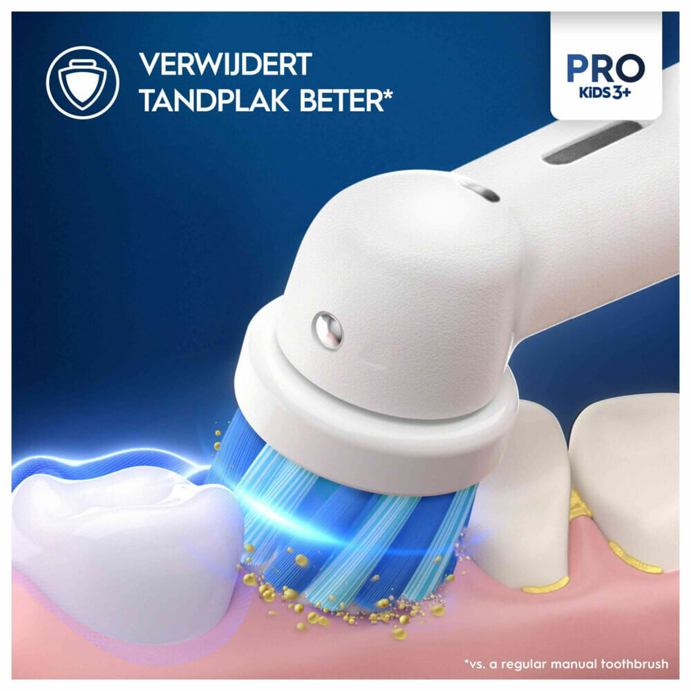 Oral-B Kids Frozen Opzetborstels | 2 stuks | Vanaf 3 Jaar