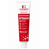 Curasept AfteRapid Beschermende Gel – 10 ml – Bij Aften & Mondzweertjes