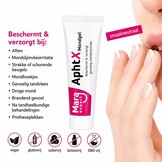 Mara Expert AphtX Mondgel | Voor Aften & Mondirritaties | 15 ml