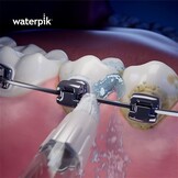 Waterpik Whitening Orthodontic Tips WOD-2E - 2 stuks