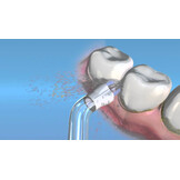 Waterpik Whitening Plaque Seeker Tips WPS-2E - 2 stuks