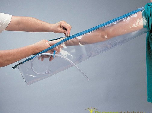 Urias®-johnstone opblaasbare spalk