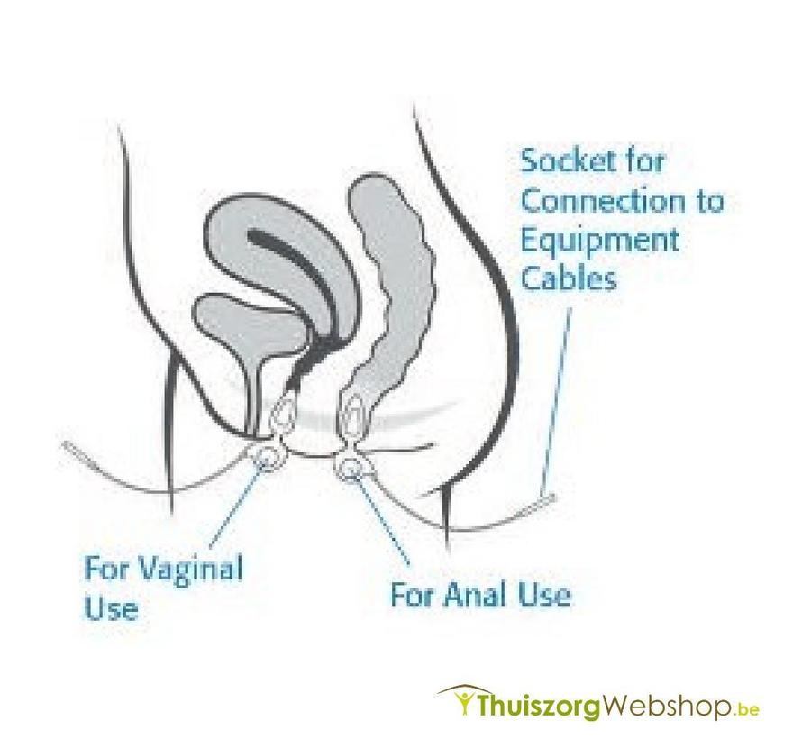 Anuform® Neen Intra anale probe