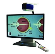 Draagbare beeldschermloep