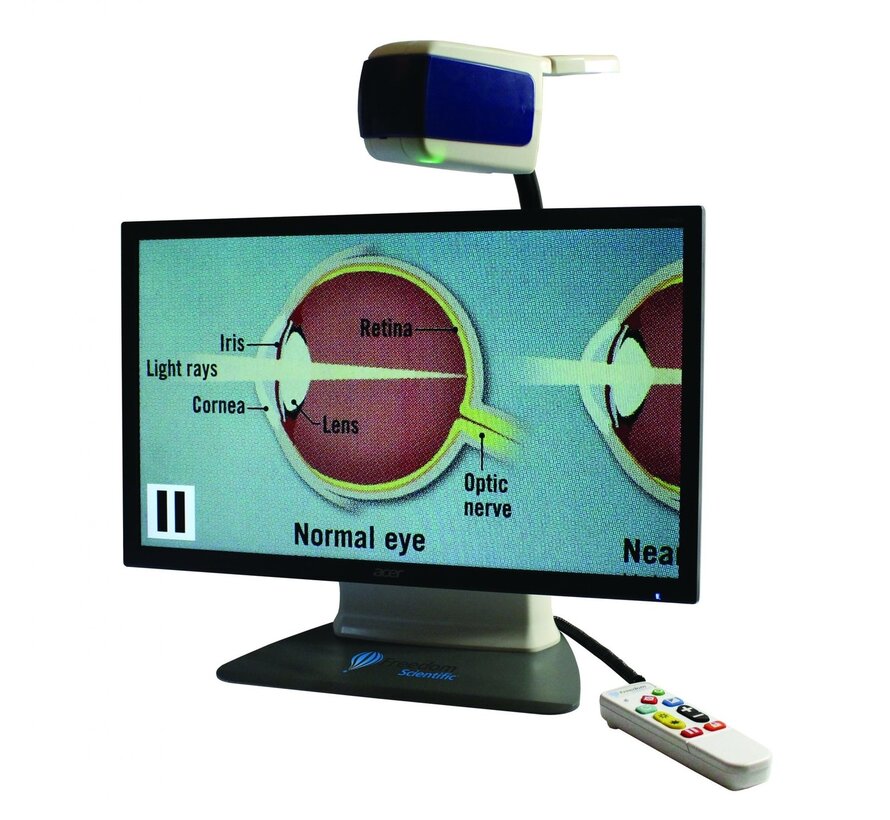 Draagbare beeldschermloep met 3 kijkopties
