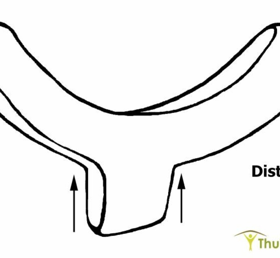 Vingerspalk Oval 8 splint - Setje van 3