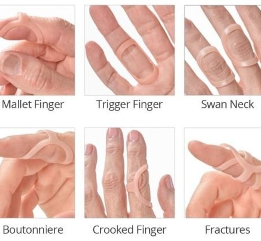 Vingerspalk Oval 8 splint - Setje van 3