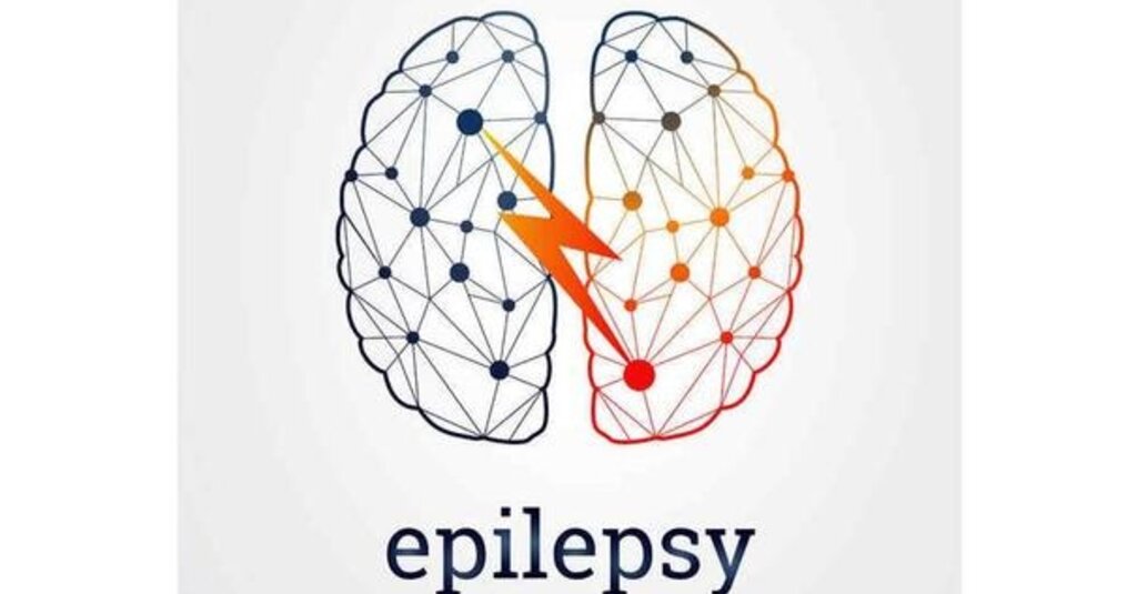 Syndroom van Lennox-Gastaut: Een ernstige vorm van epilepsie bij kinderen