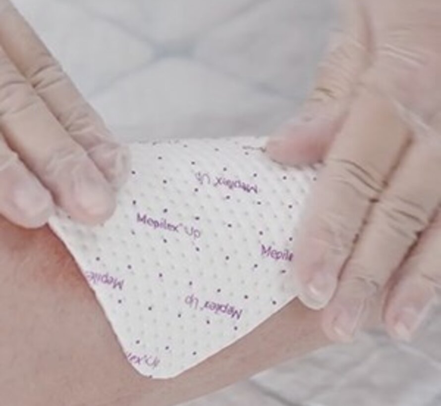 Hydrocellulaire verbanden