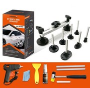 TM TM Dent Removal Set, Dent Removal Without Spray XL