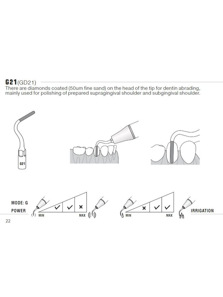 EMS compatibel Woodpecker  Inlay tip G21 EMS compatibel