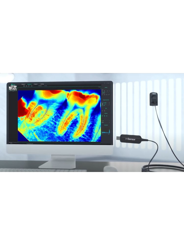 i-Sensor digitale sensor/detector voor tandheelkundige radiologie Sensor afmetingen 28-H2: 40 x 31mm (1.240 mm²)