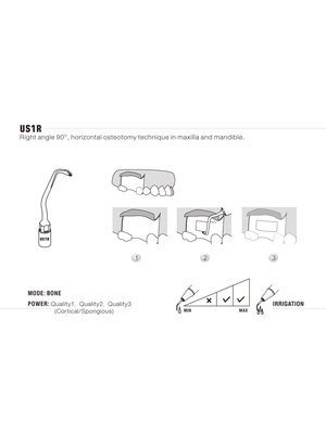 Woodpecker US1R Ultrachirurgische botchirurgie