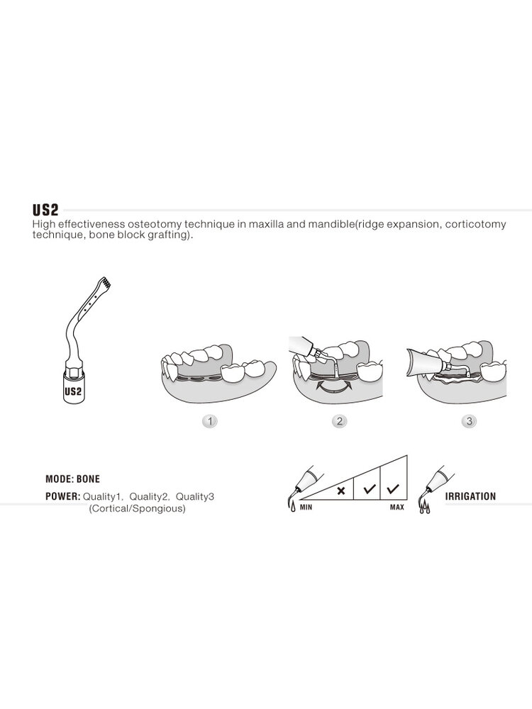 Woodpecker US2 Ultrachirurgische Knochenchirurgie