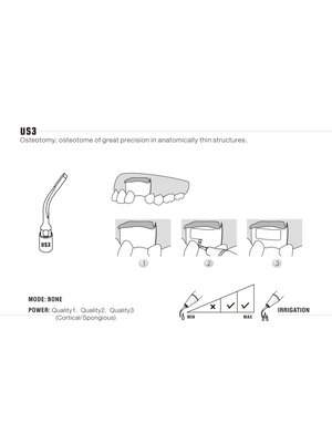 Woodpecker US3 Chirurgie osseuse ultrachirurgicale