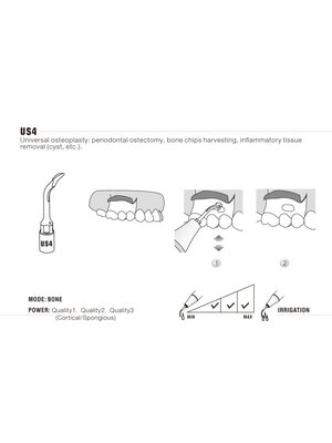 Woodpecker US4 Ultrachirurgische Knochenchirurgie