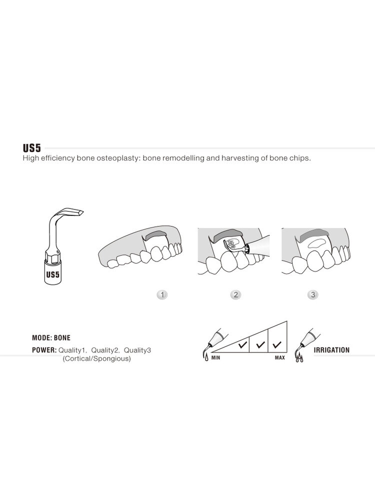 Woodpecker US5 Chirurgie osseuse ultrachirurgicale