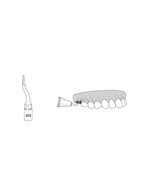 Woodpecker UC2 Extraction ultrachirurgicale