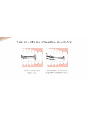 Woodpecker Endo radar Plus mit eingebautem Apex Locator  ARI