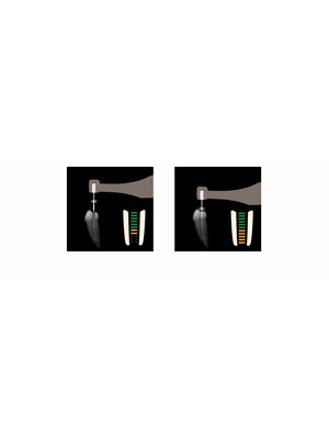 Woodpecker Endo radar Plus mit eingebautem Apex Locator  ARI