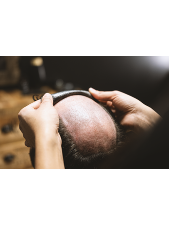 Formation prothésiste capillaire