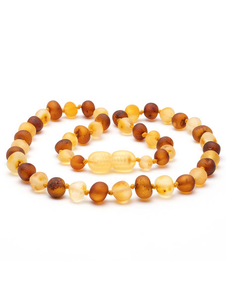 Amber Barnsteen baby ketting 32cm - cognac/honey raw