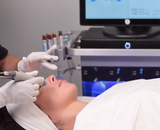 Hydrafacial de nieuwste Beauty Trend