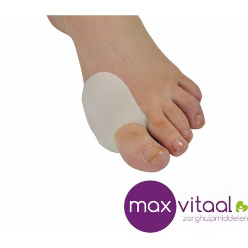 Eeltknobbelbeschermer gel