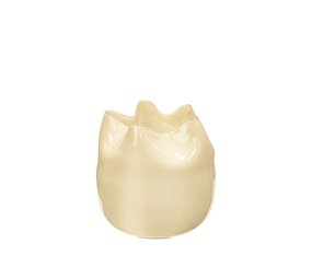 Broste Copenhagen Esther Vase gelb Ø30cm