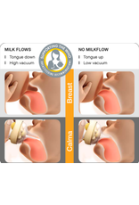 Medela Medela Calma voedingssyteem - zonder fles