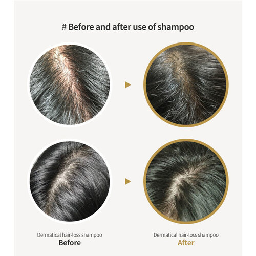 Lador Dermatical Hair-Loss Shampoo  For Thin Hair Lador Dermatical Hair-Loss Shampoo  For Thin Hair