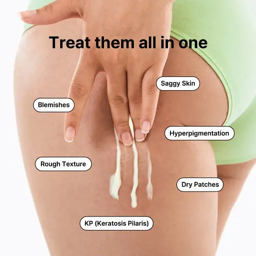 By Wishtrend Vitamin A-mazing Bakuchiol Body Lotion By Wishtrend Vitamin A-mazing Bakuchiol Body Lotion