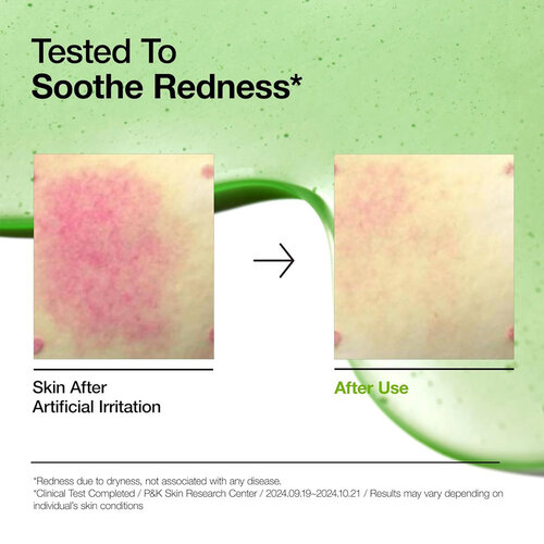 Anua Azelaic Acid 10 Hyaluron Redness Soothing Serum Anua Azelaic Acid 10 Hyaluron Redness Soothing Serum