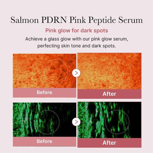 Medicube PDRN Pink Peptide Serum