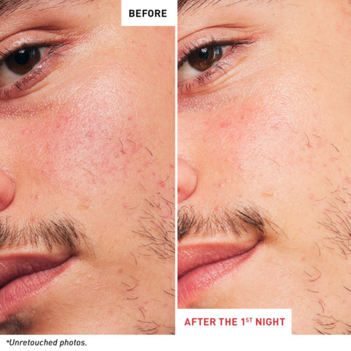 Erborian Skin Therapy