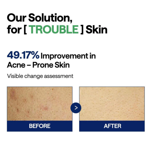 Mediheal Teatree Trouble Pad Mediheal Teatree Trouble Pad