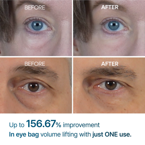 Dr.Melaxin Eyephalt Eyebag Cream