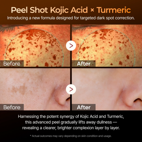 Dr.Melaxin Peel Shot Exfoliating Kojic Acid Turmeric Serum Dr.Melaxin Peel Shot Exfoliating Kojic Acid Turmeric Serum