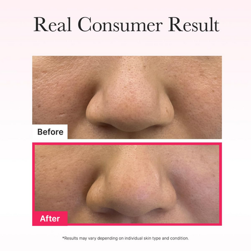 Arencia Red Collagen Jello Mask Arencia Red Collagen Jello Mask