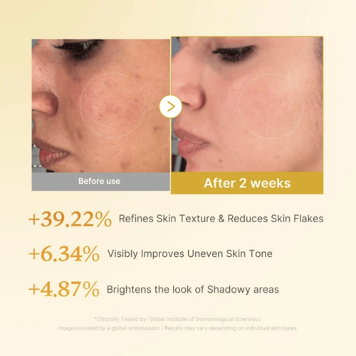 Medicube Kojic Acid Turmeric Resurfacing Toner Medicube Kojic Acid Turmeric Resurfacing Toner