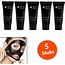 AFY Peel Off Acne Zwart Gezichtsmasker / Blackhead Masker (5 Stuks)