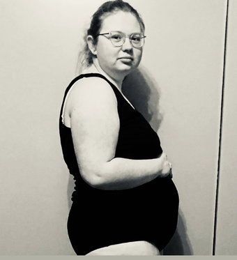 Een loslatende placenta Een loslatende placenta