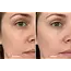 SILSKIN SILSKIN ANTI-RIMPEL COMBI-DEAL