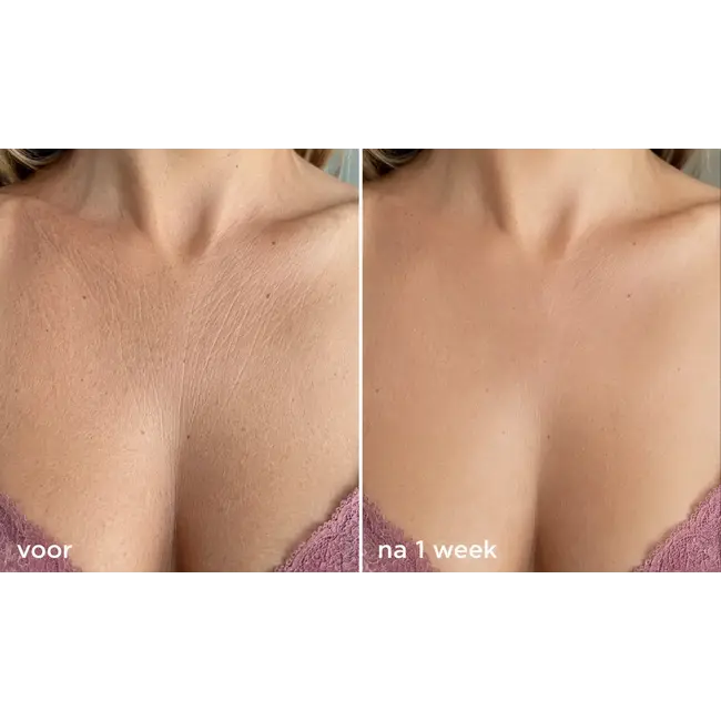 SILSKIN SILSKIN ANTI-RIMPEL  DECOLLETÉ