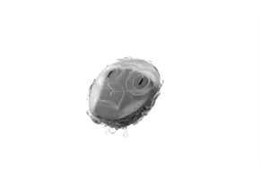 MED-EL WaterWear voor SAMBA (2)