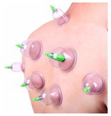 KL 20-Delige Cupping Set met 6 Formaten Cups Pull Out Vacuüm Apparaat | Cupping Therapy Set Anti Cellulitis | Chinese Massage Therapie | Vacuüm Cups Therapie met Pomp | Wellness | Anti Cellulite
