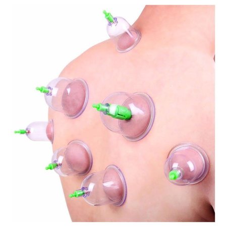 KL 20-Delige Cupping Set met 6 Formaten Cups Pull Out Vacuüm Apparaat | Cupping Therapy Set Anti Cellulitis | Chinese Massage Therapie | Vacuüm Cups Therapie met Pomp | Wellness | Anti Cellulite